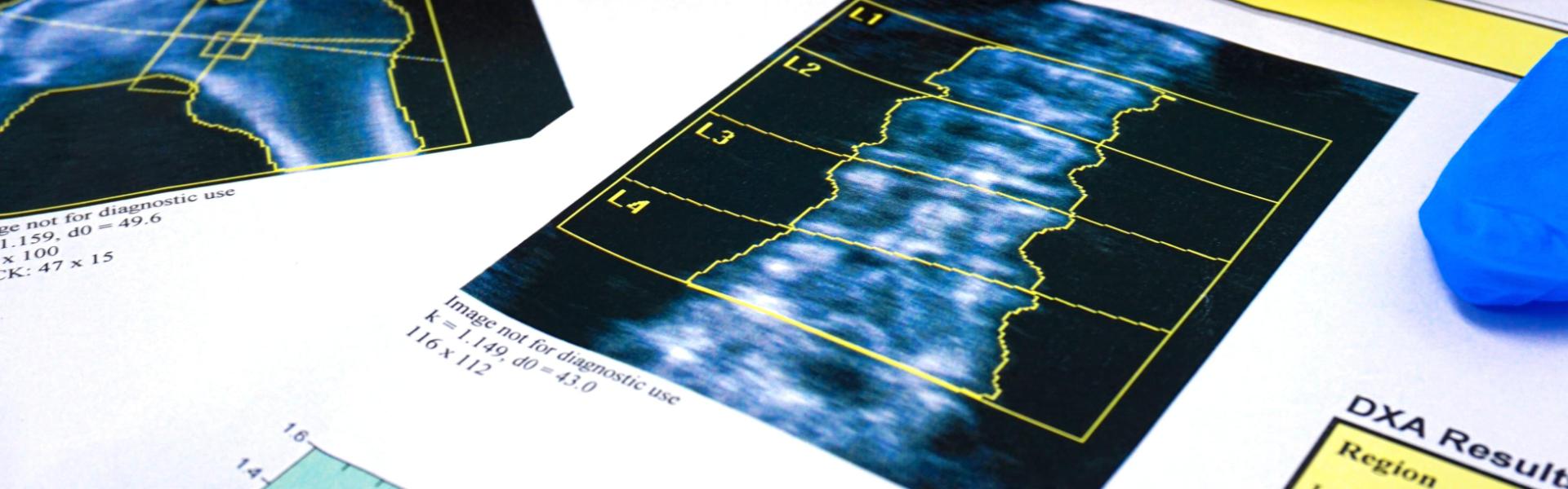 Prof Cert in Dual Energy X-ray Absorptiometry (DXA) scan